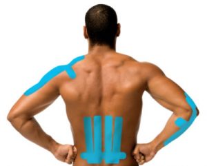 Kinesio Taping is just one of the treatments available at The Recovery Suite at Back to Health in Southbury, Connecticut.